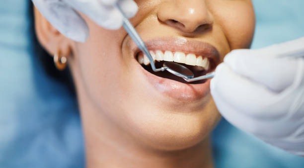 Best Emergency Gum Treatment in Palmetto Estates, FL